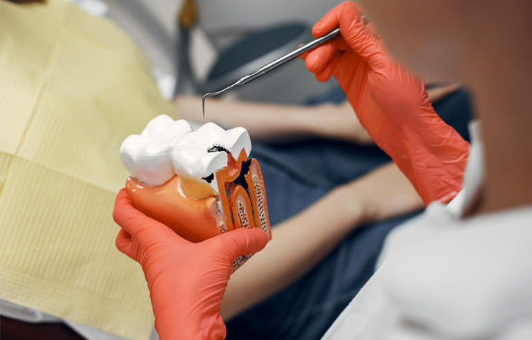 Relación entre el COVID19 y la periodontitis - Clínica Dental en Avilés - LUZ DENTAL 
