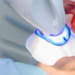 ¿Cómo funciona el blanqueamiento dental?. Luz Dental, dentistas en Avilés