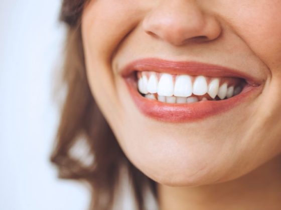 Luz Dental. Los tratamientos dentales estéticos mejoran la salud bucodental